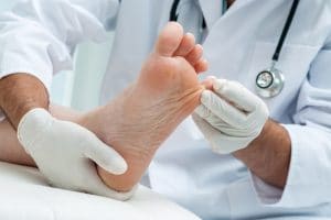 Fußpilz Symptome erkennen - Fußpilz zwischen den Zehen